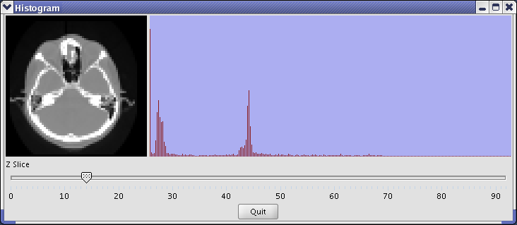 [Histogram]